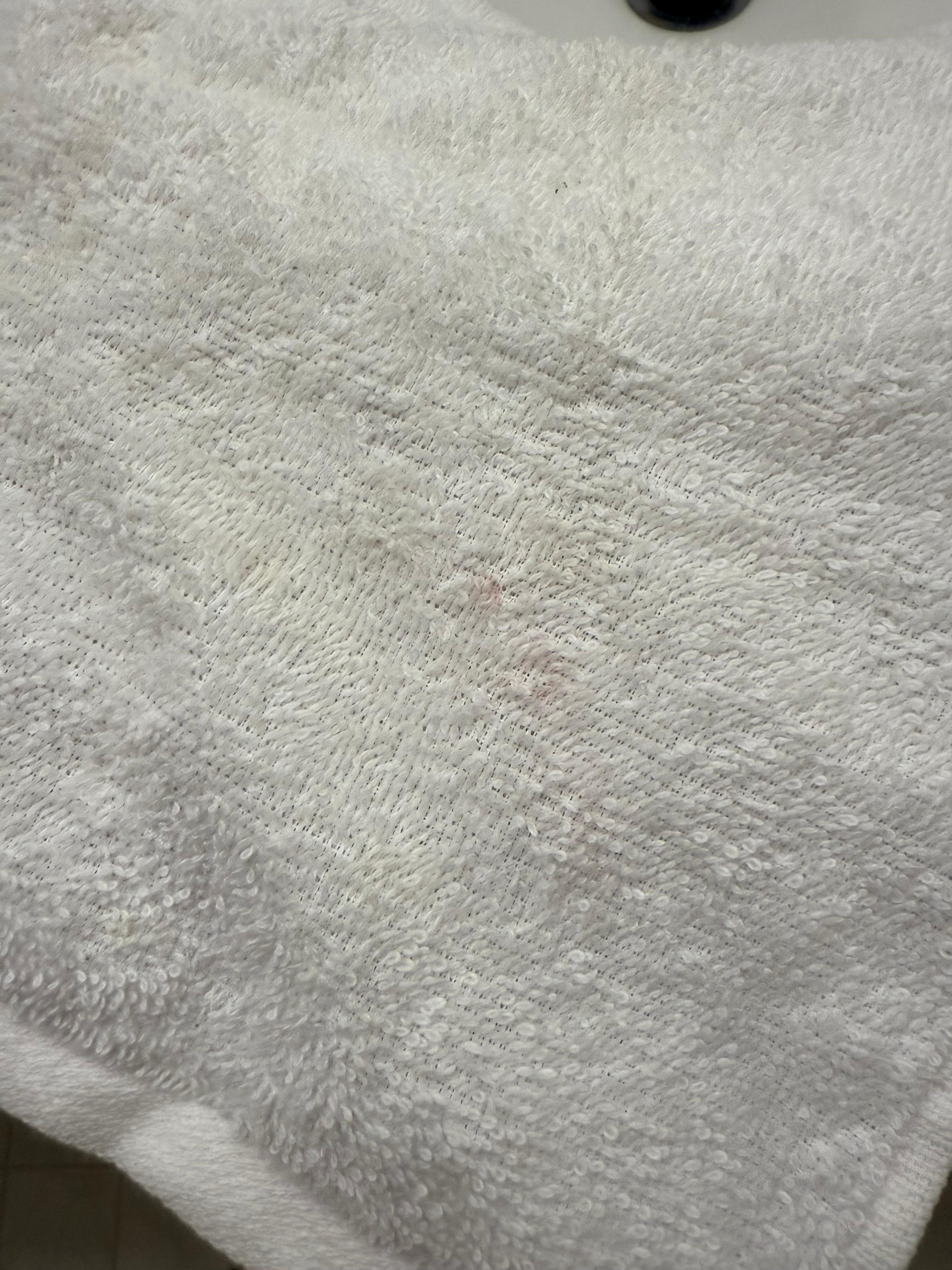 First place that was  offered to us: Face cloth dirty