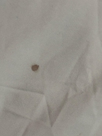Bloodspot on sheet