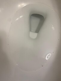 Floaties left behind in toilet water.