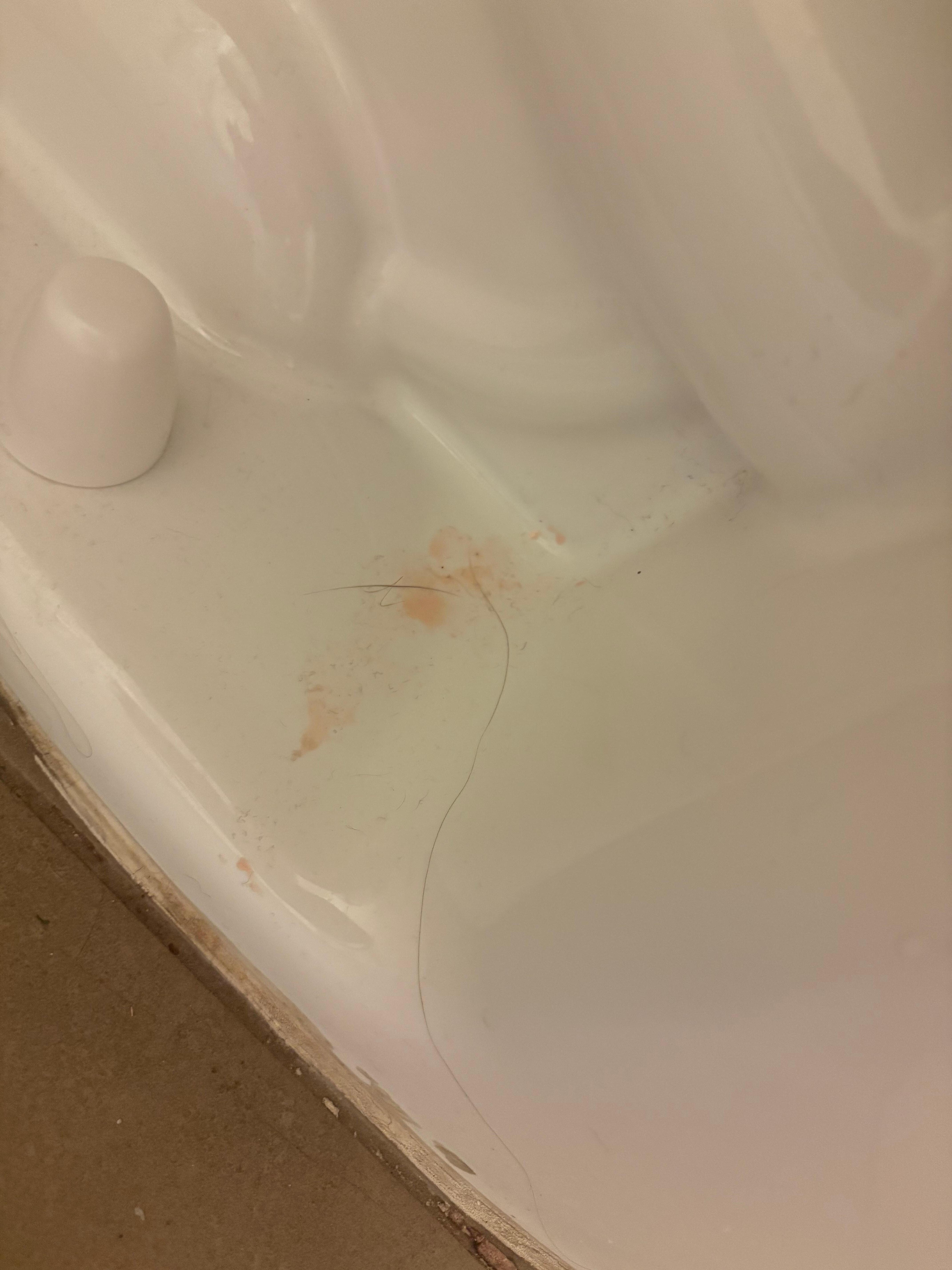 is that blood?😪