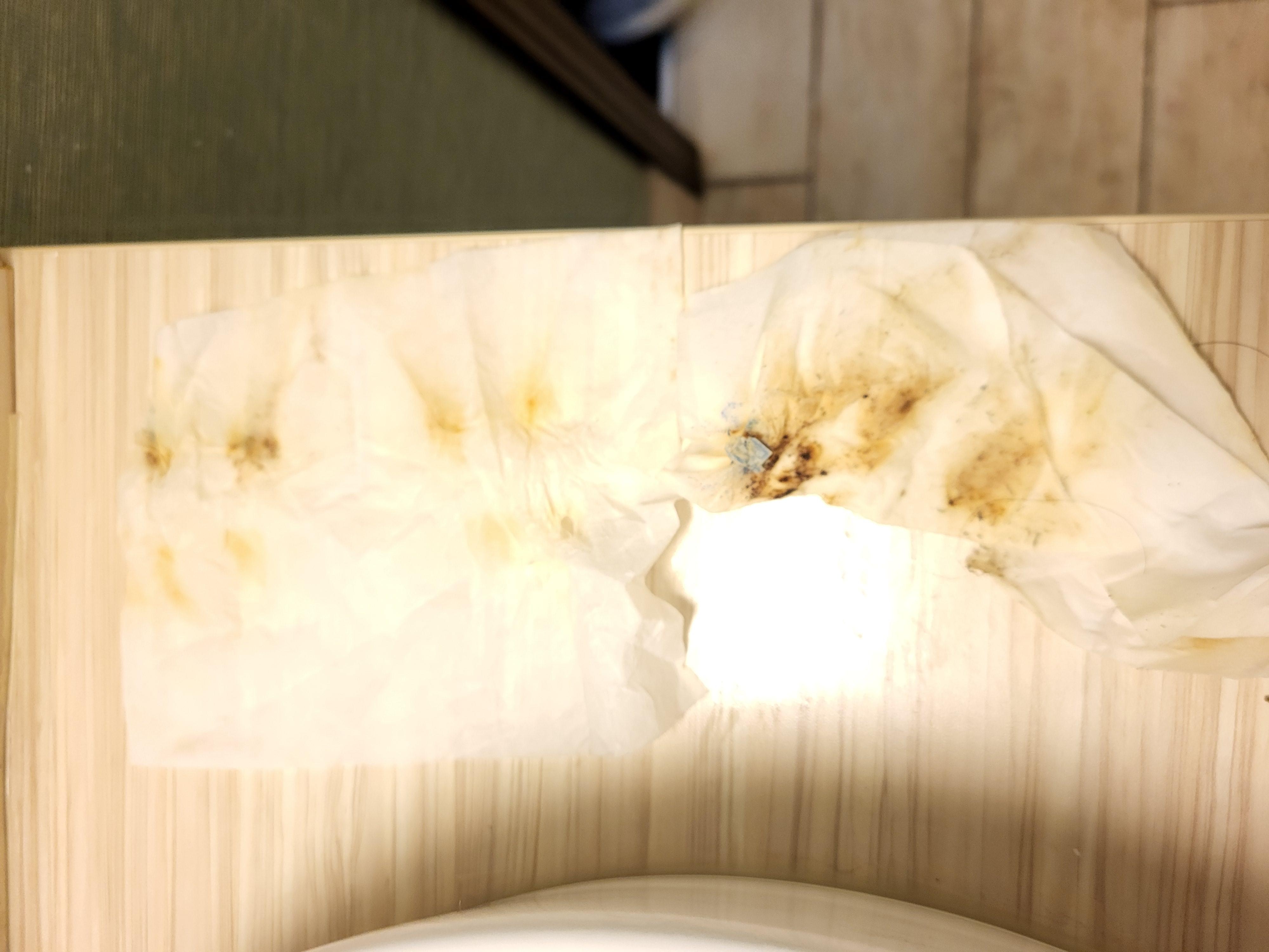 The wipes I cleaned the toilet with