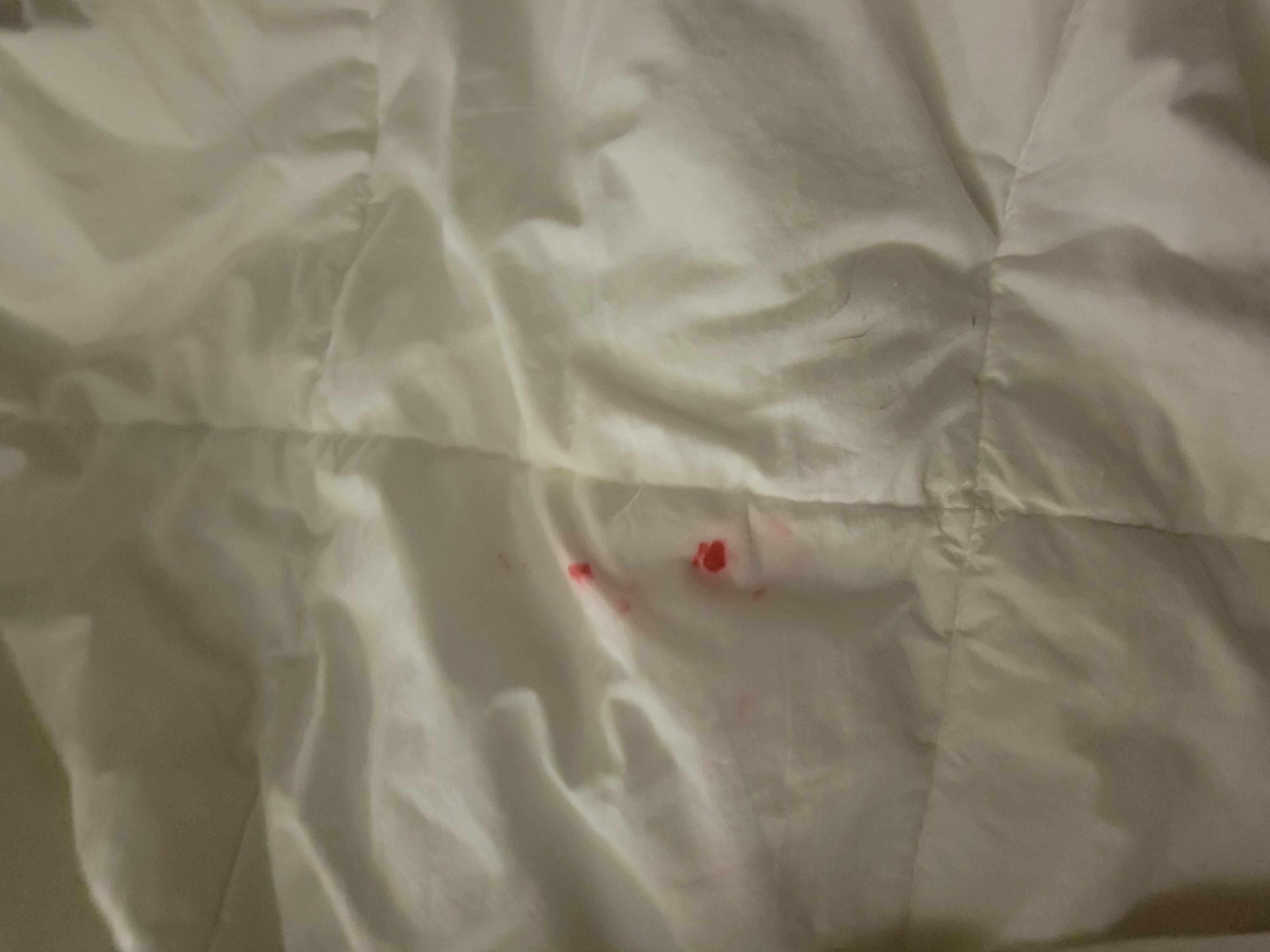 Bed stains