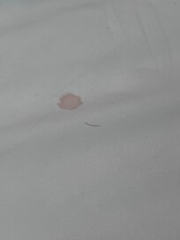 Blood stain and hair. Neither were ours.