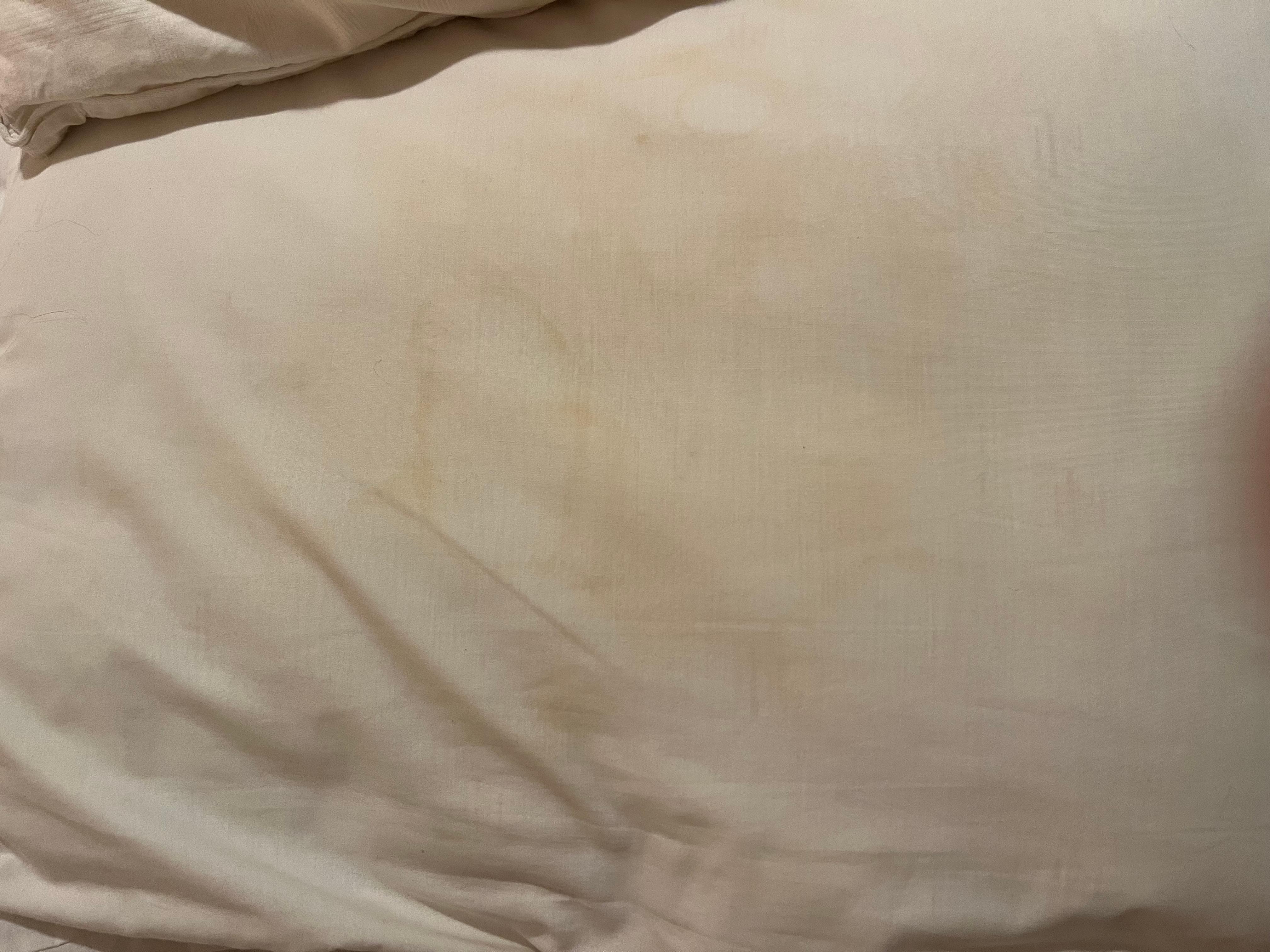 Dryer blood on the pillow. 