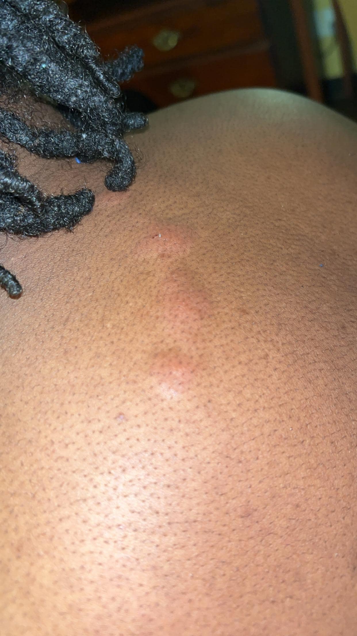 Room 210 has bugs biting you all in the middle of the night. Back shoulders arms. Only the top part of the bed is where it was happening 