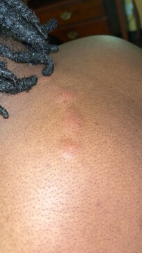 Room 210 has bugs biting you all in the middle of the night. Back shoulders arms. Only the top part of the bed is where it was happening