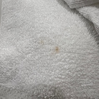 Stain found in the towels