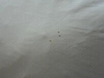 Stained sheets (dark spots)