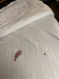 Blood found on bed linen