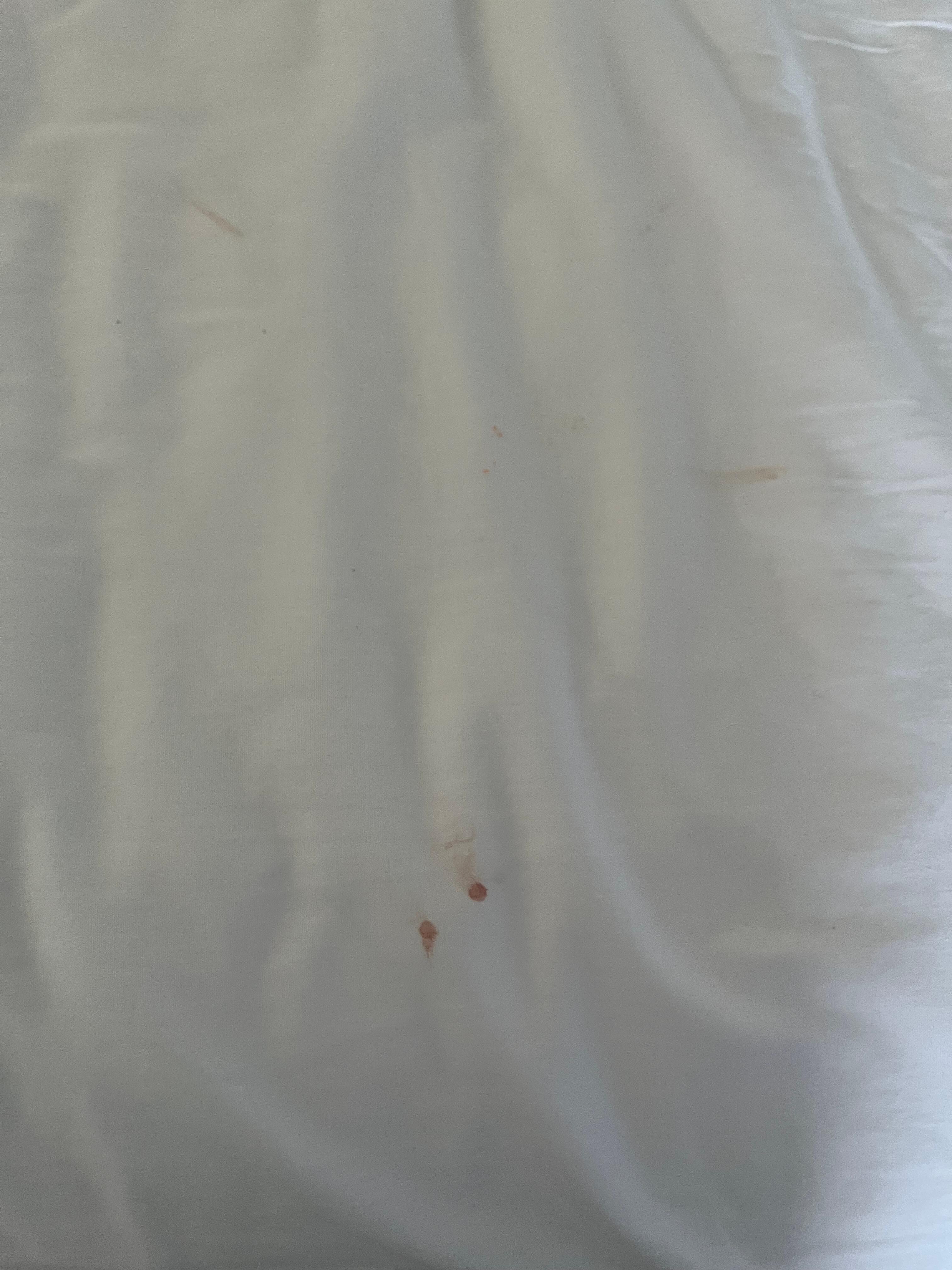 Blood on the sheets of my sons bed