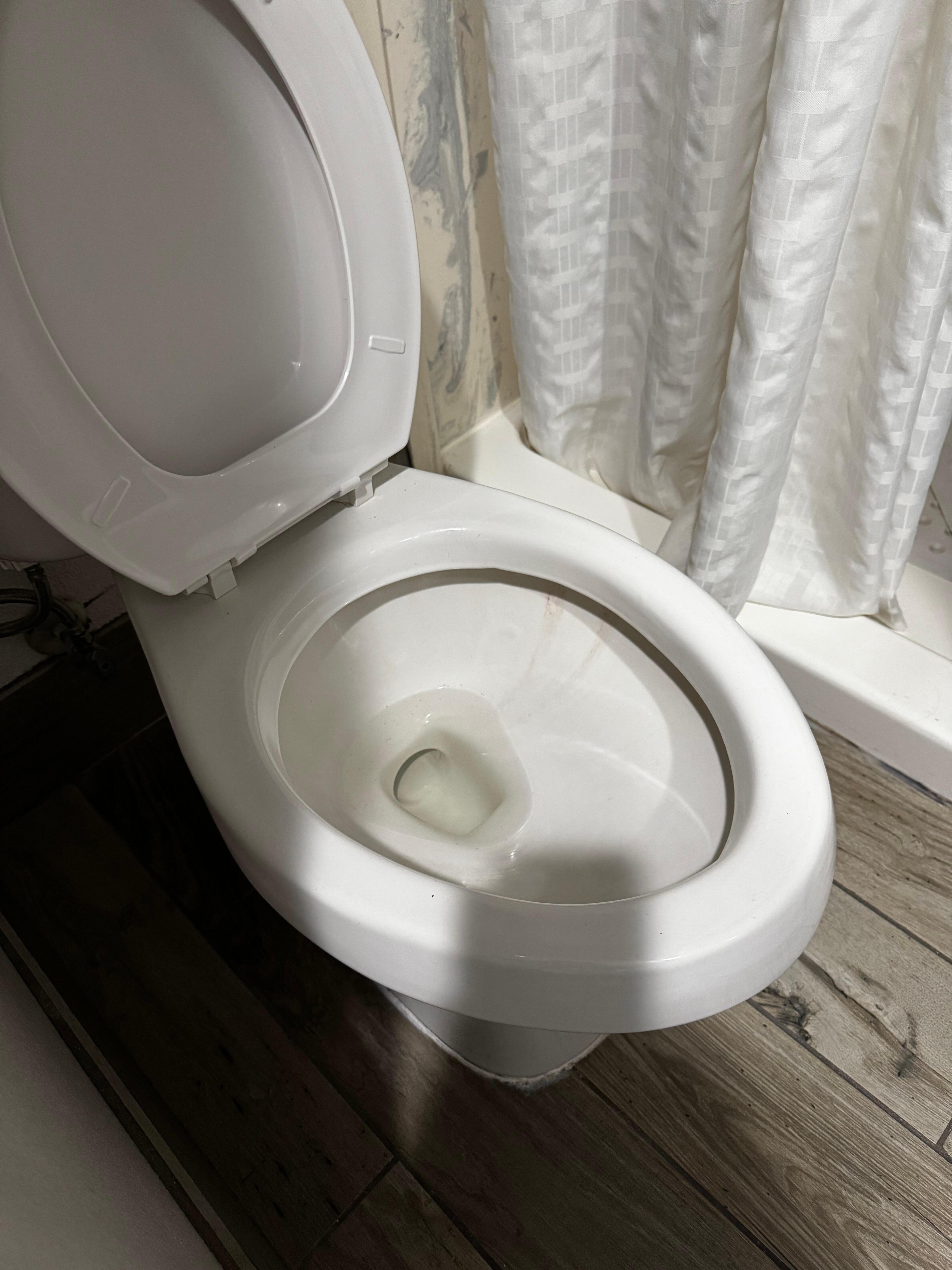 Filthy toilet 