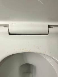 Dirty toilet