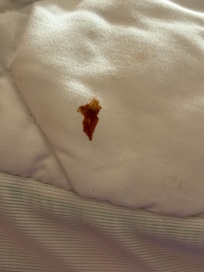 Blood on the mattress pillow top cover. Noticed this after I took the linen off to help housekeeping as we was leaving.