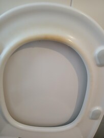 Verschmutzter Toilettendeckel