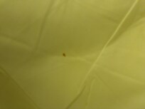 Debris in mattress