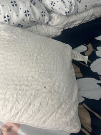 Live Bed bug on pillow in the bed slept in on Smith Street.