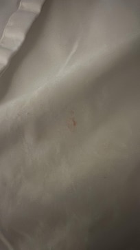 One of several drops of blood