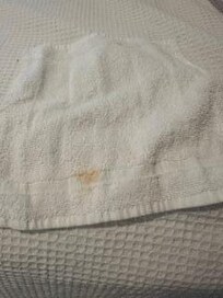 dirty towels