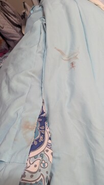 Blood on comforter