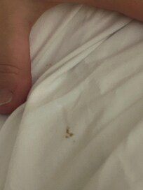 That’s on the pillow