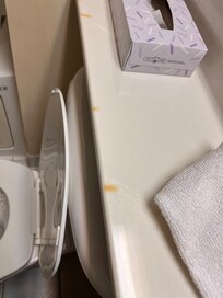 Cigarette burn marks