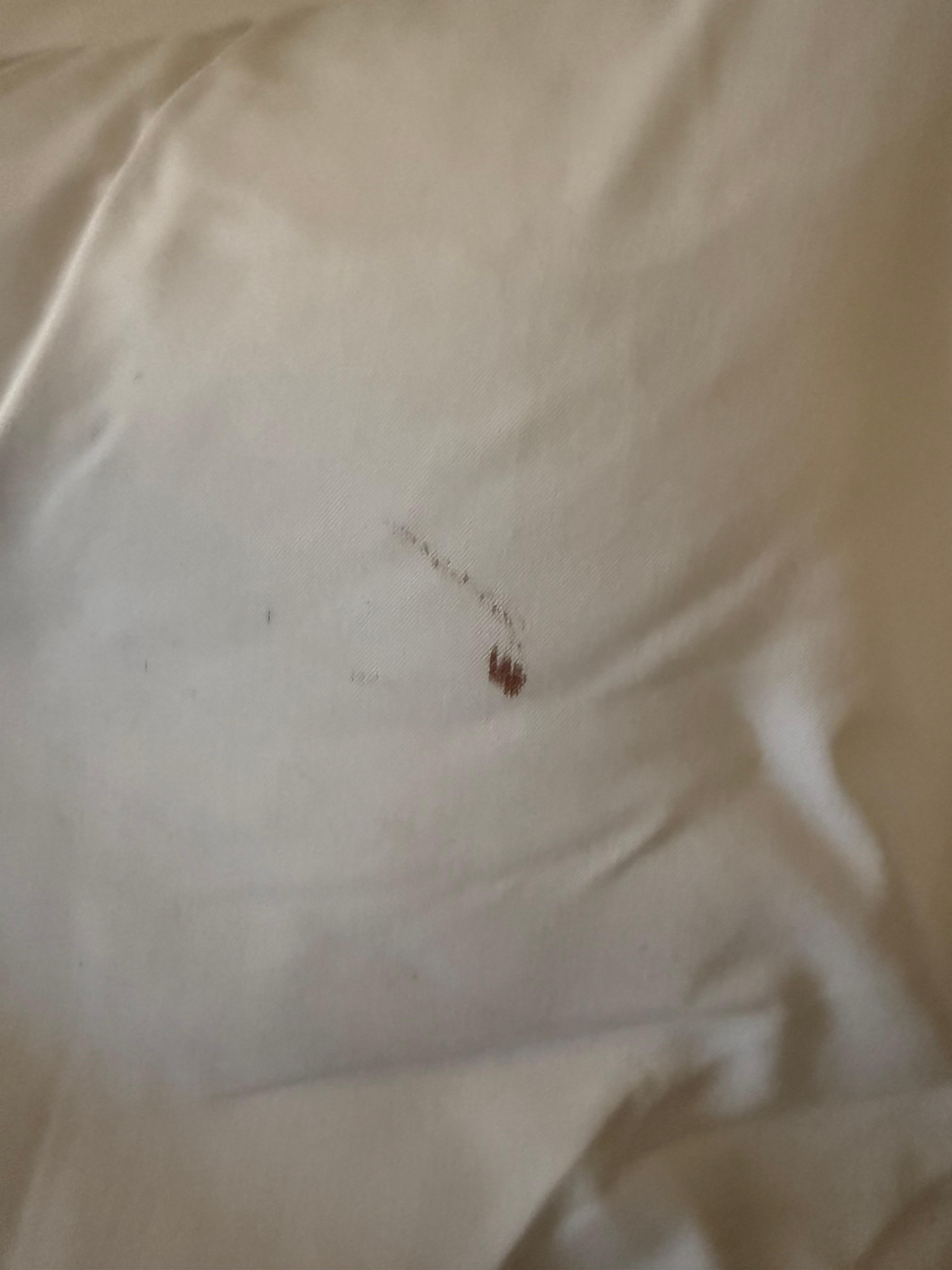 Dries blood on the pillowcase 