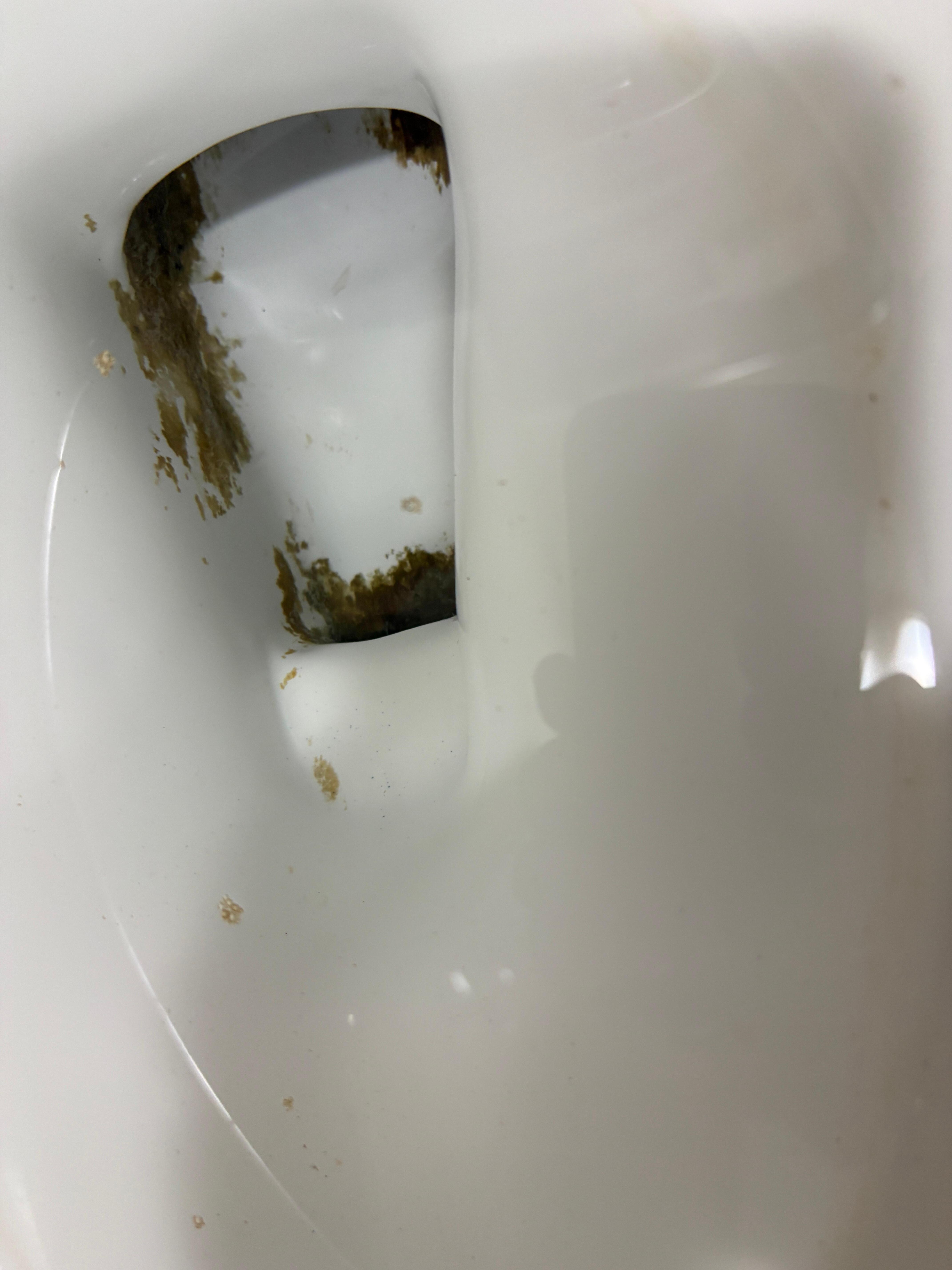 Poop