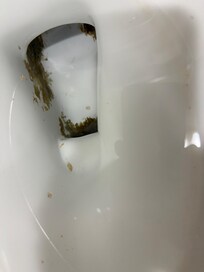 Poop
