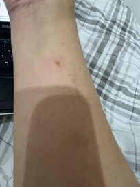 leg