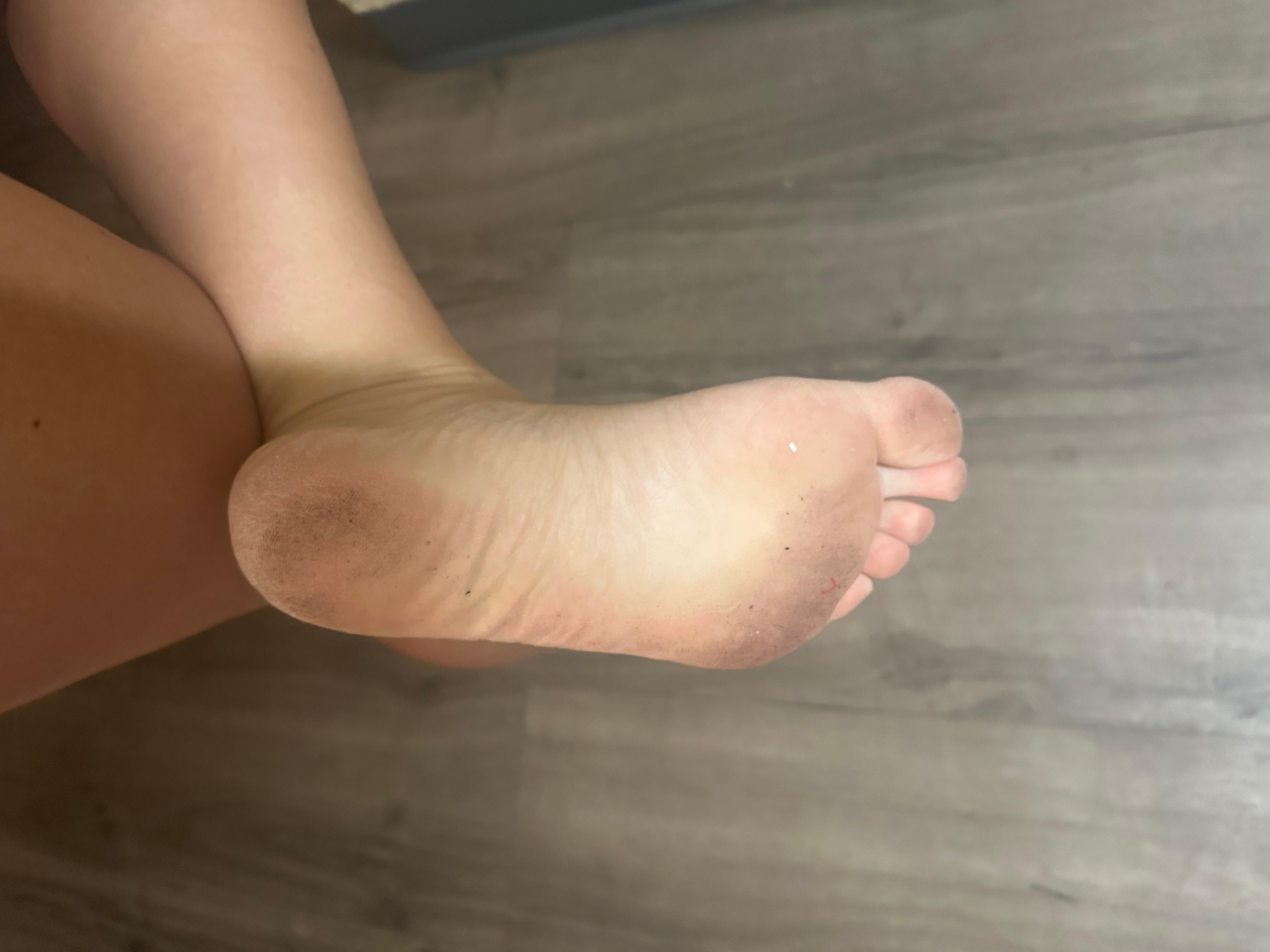 Walking on the floor for less than 10 min and my feet looked like this.