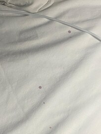 blood stains