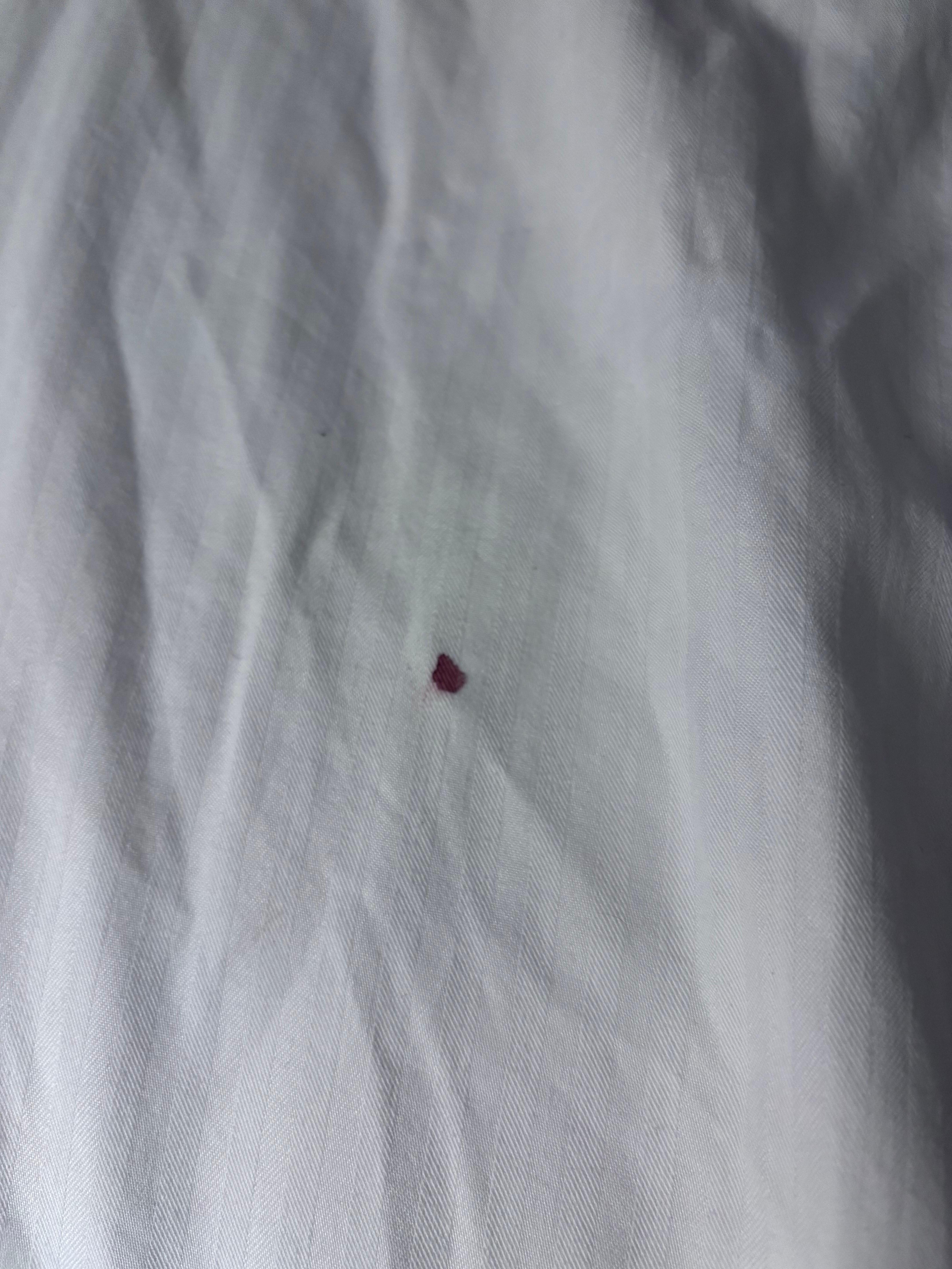 Blood stain in the bed