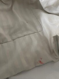 This was near my head. It looked like hard red candy that was stuck on the bed with the top sheet over it.