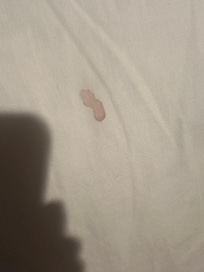 Stains on pillow cases