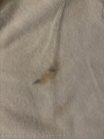 Marks on towels