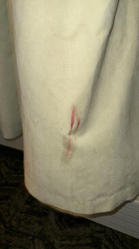 Red substance on curtain