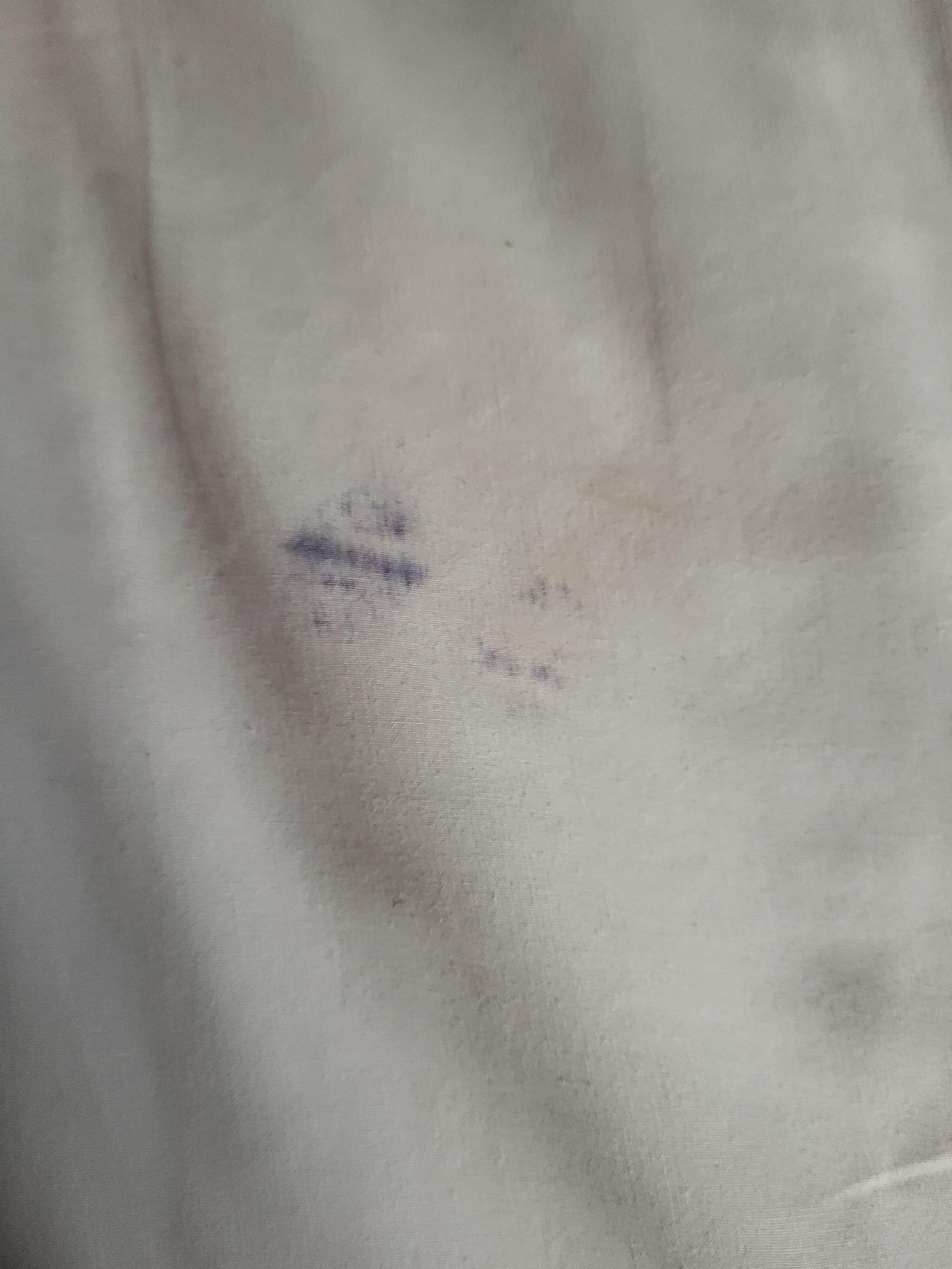 Stains on the bed sheets