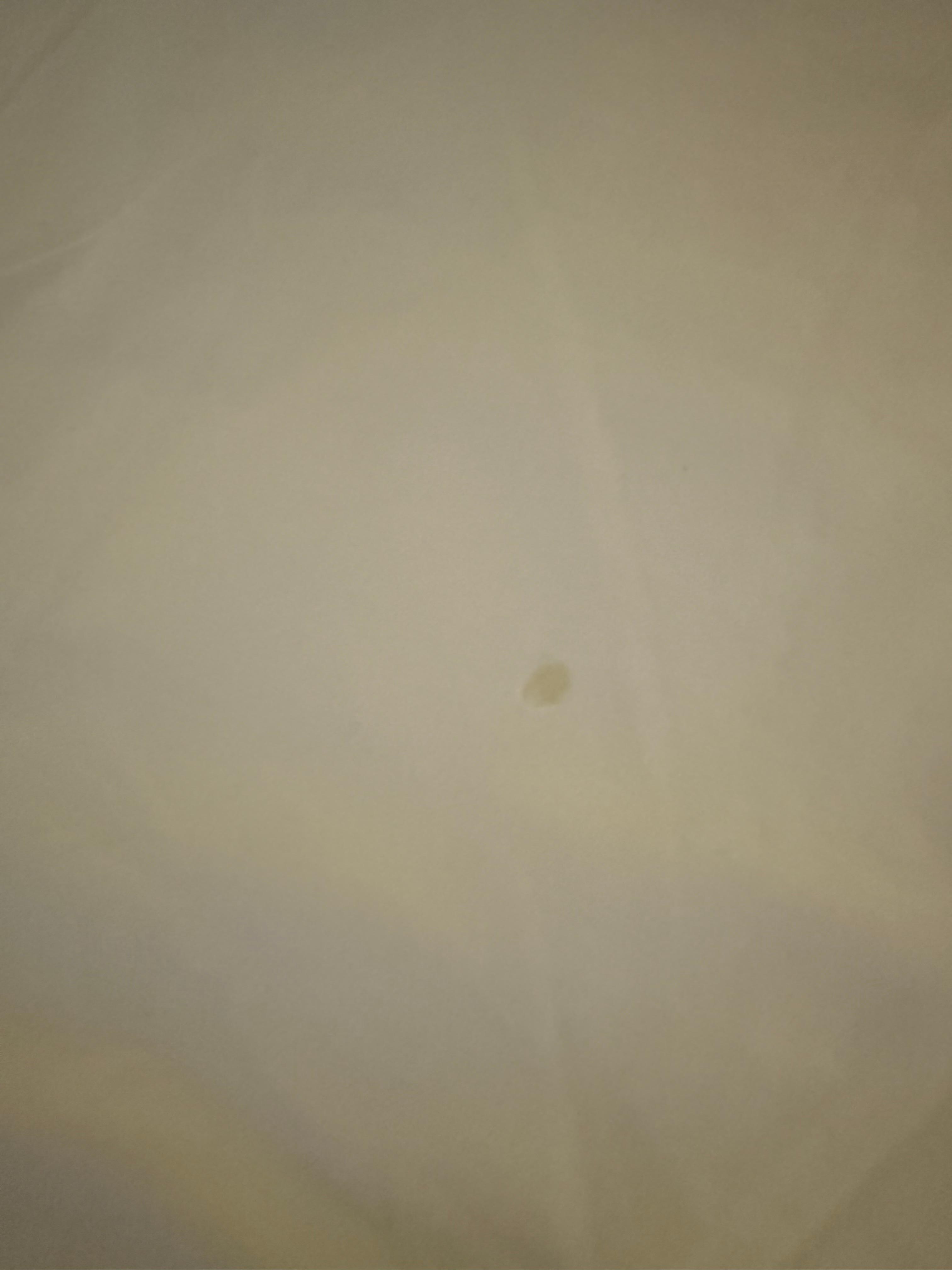 Stains on bed sheets