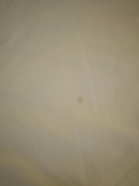 Stains on bed sheets
