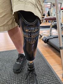 Received my new leg from a step ahead clinic in Hicksville