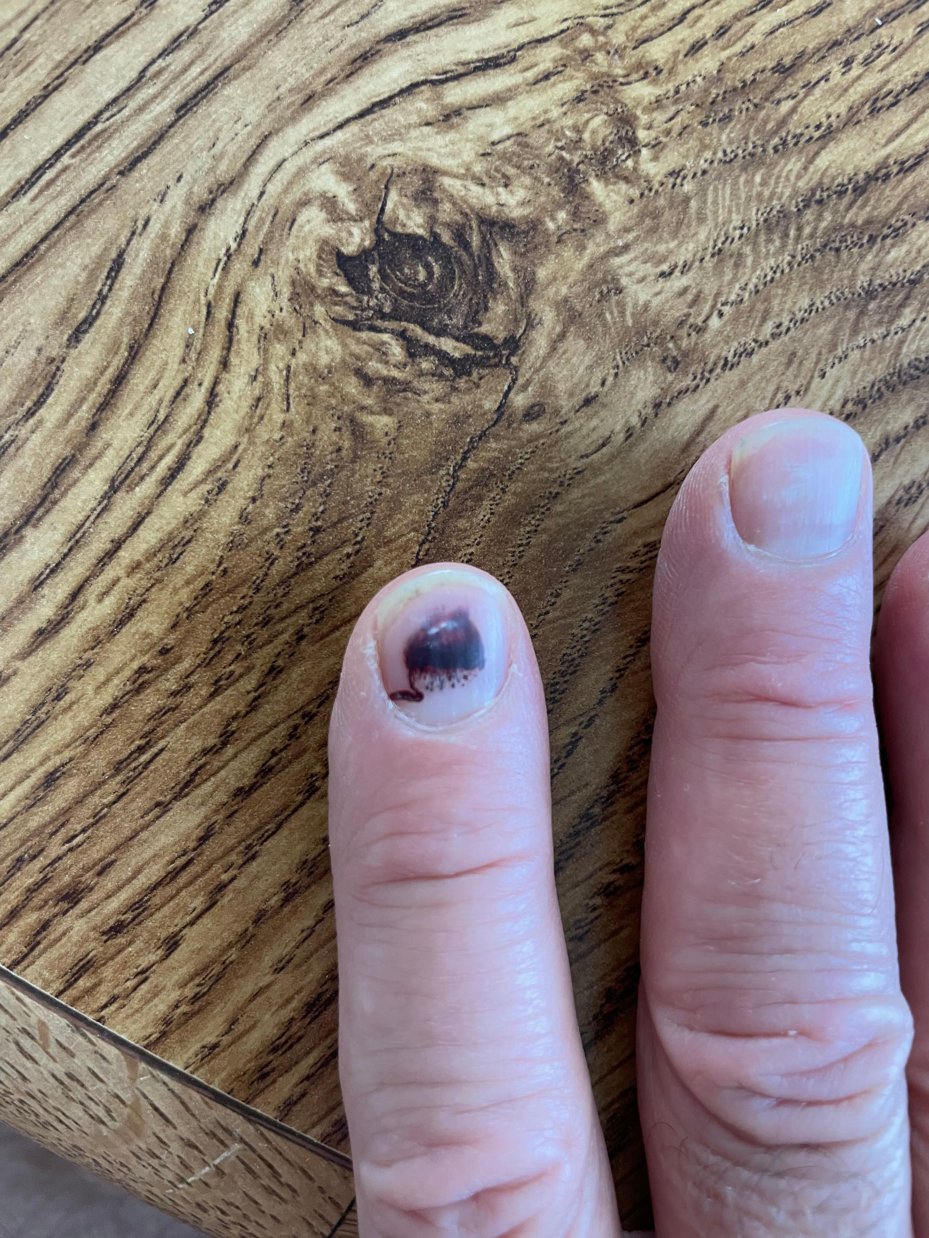 Great location, rooms are fine, except the large bay window in our room was propped up with metal pineapple juice cans. As night fell and it became cold, I closed the window. I underestimated the weight of it, and it slammed down hard on my fingers. 