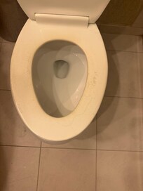 Dirty toilet seat
