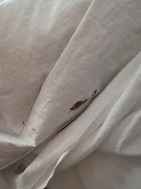 Dried blood on comforter
