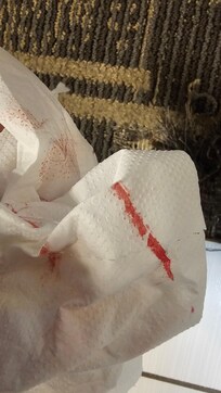 Clavos oxidados me cortaron el pie