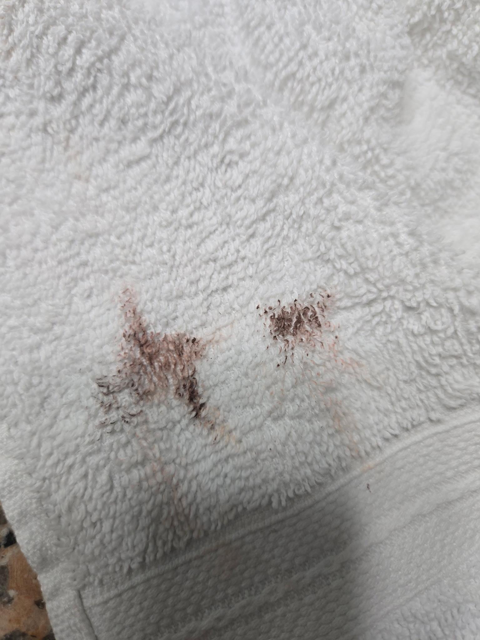 Used towels prior to receiving clean. 