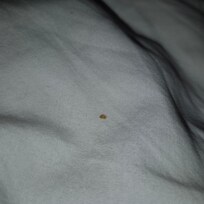 Bed bug. Several more photos but limited on photos