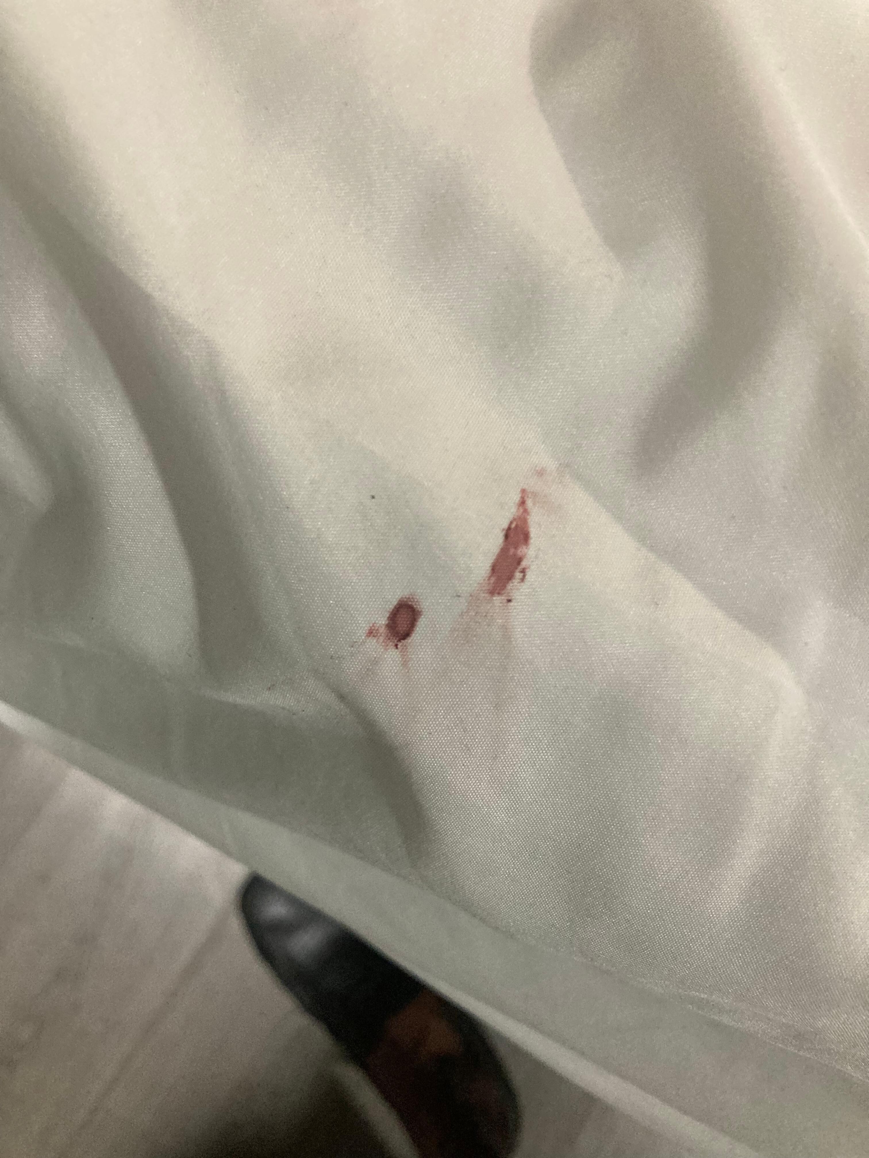 Blood on sheets