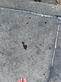 More blood