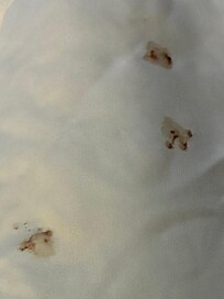 Bloody mucus on comforter