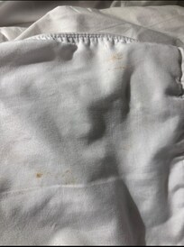 Stains on bed sheets.